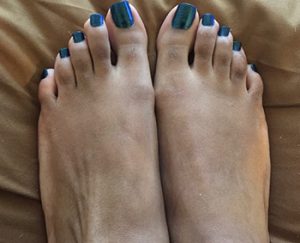 toes